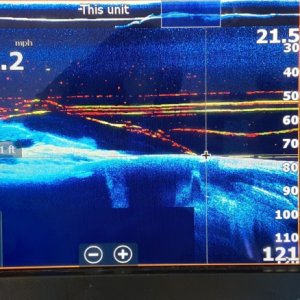 Gen 3 structure scan display