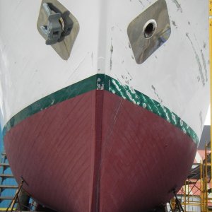 SSC CPR and Patient 015