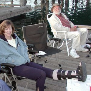 (Pat Anderson)  Dana and Bob (Da nag), Dana Showing Off Latest Fashion in Leg Braces (Beats a Cast Hands Down)